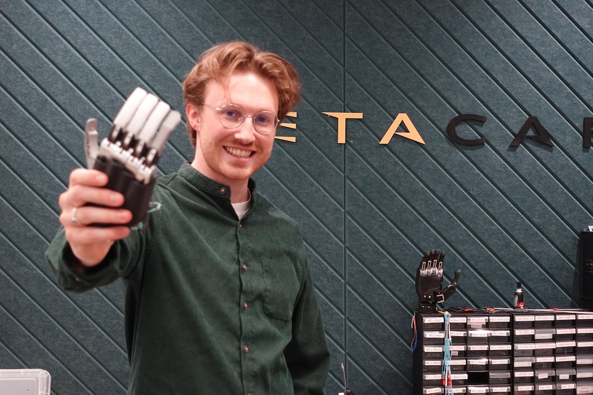 Edinburgh bionic hand startup raises £800,000 funding